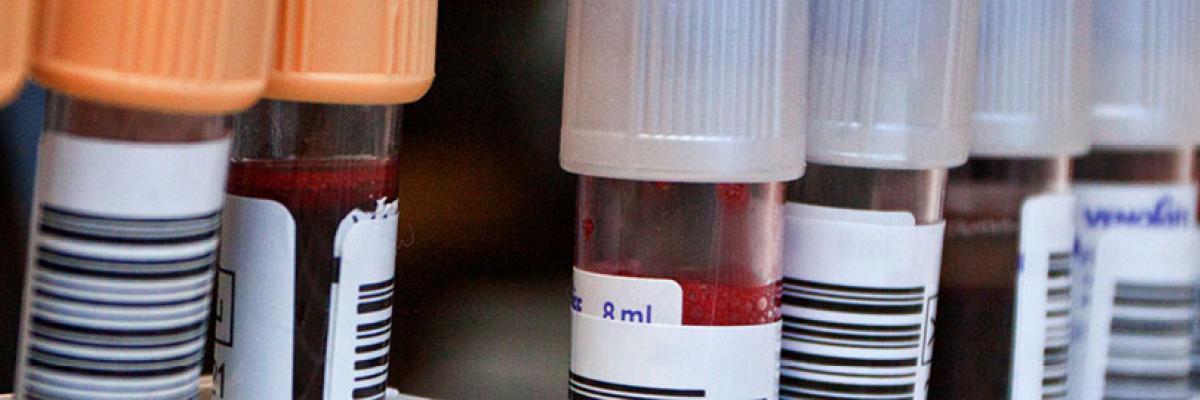 Blood samples