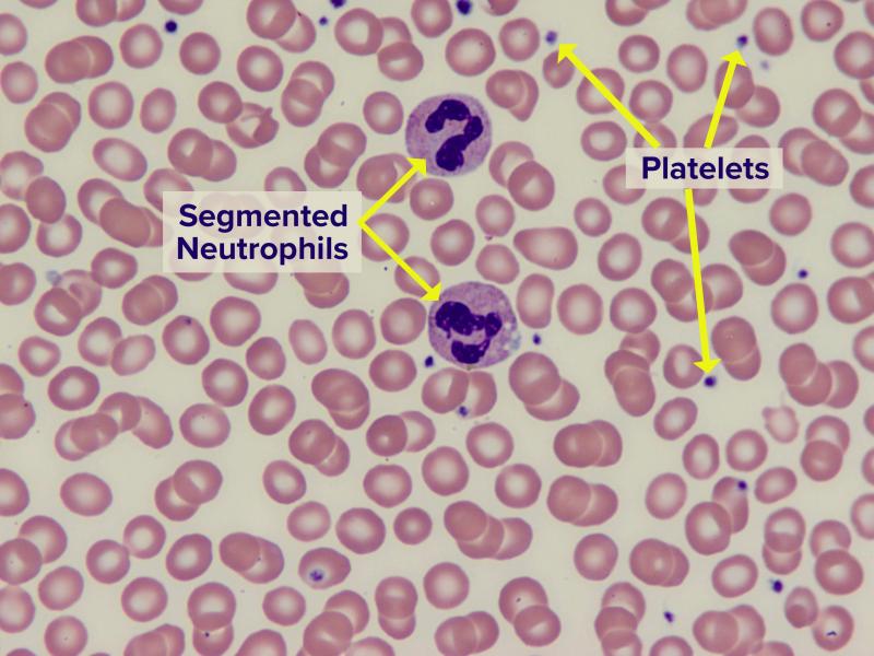 Image of normal blood smear